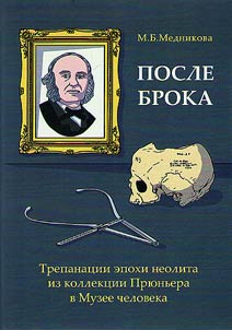 Posle Broka